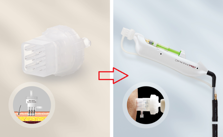 부산케이피부과_더마샤인프로_멸균주사침3 (1).png