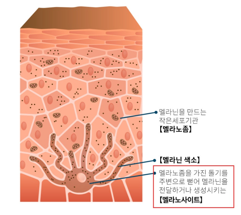 부산 레블라이트토닝 10회 전후 PIH 치료_03.jpg