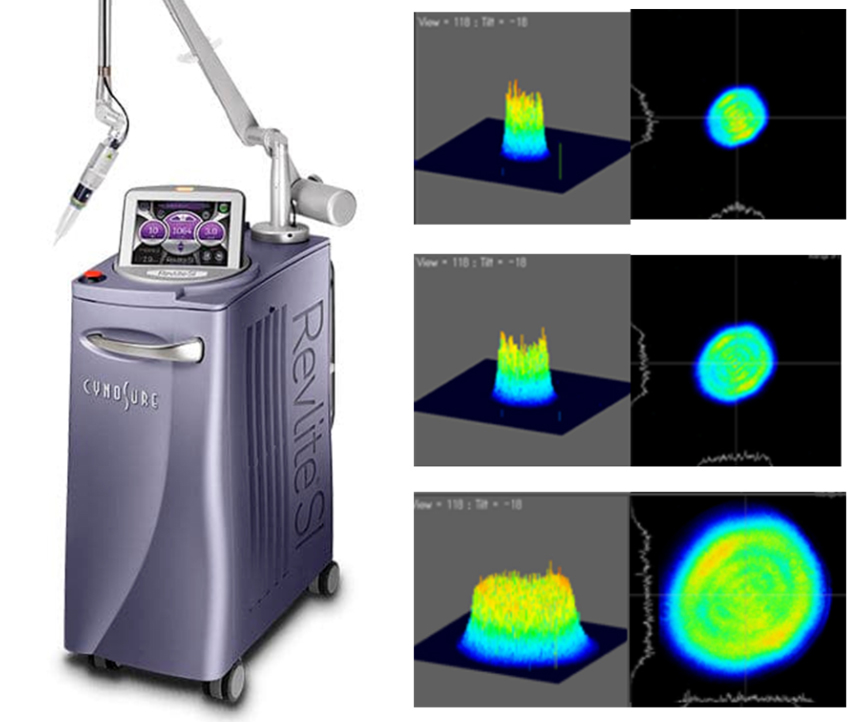 부산 레블라이트토닝 10회 전후 PIH 치료_02.jpg