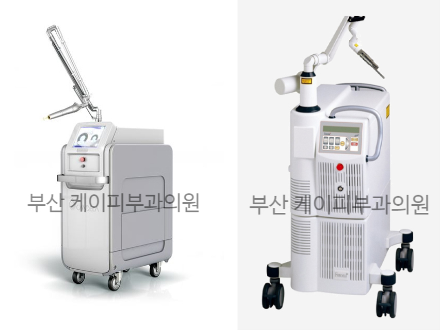 부산 오타모반 레이저 치료_05.jpg