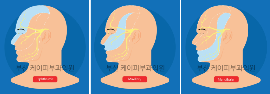 부산 오타모반 레이저 치료_01.jpg