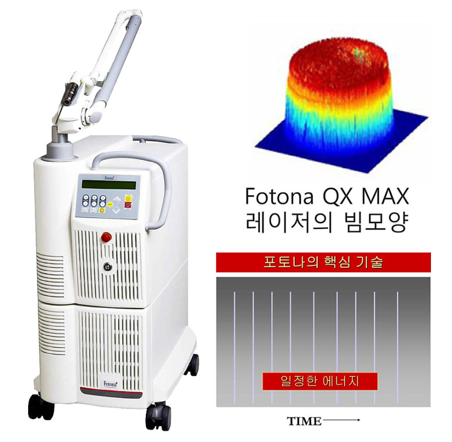 부산 갈색반점 밀크커피반점 제거 치료_03.jpg