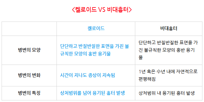 켈로이드흉터 치료 레이저 효과_01.jpg