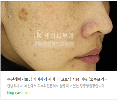 부산 해운대 기미 레이저토닝(피코토닝) _05.jpg