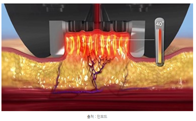 스크린샷 2025-06-05 144336.png