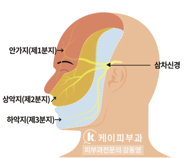 부산 선천성 오타모반 레이저 제거_02.png