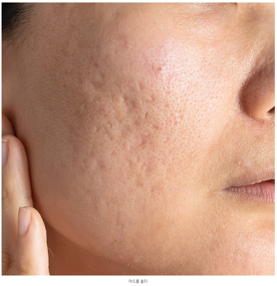 스크린샷 2025-06-05 144550.png