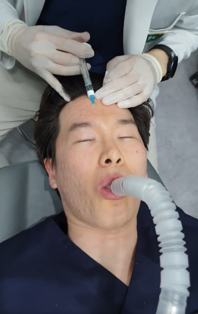 리쥬란힐러 손주사 VS 리쥬메이트 시술_05.jpg