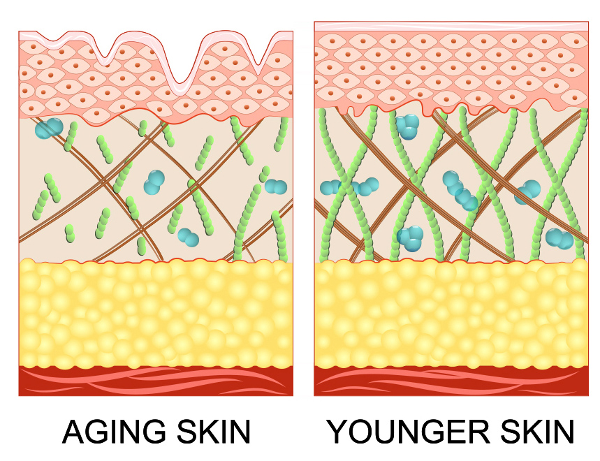 리쥬란힐러 손주사 VS 리쥬메이트 시술_01.jpg