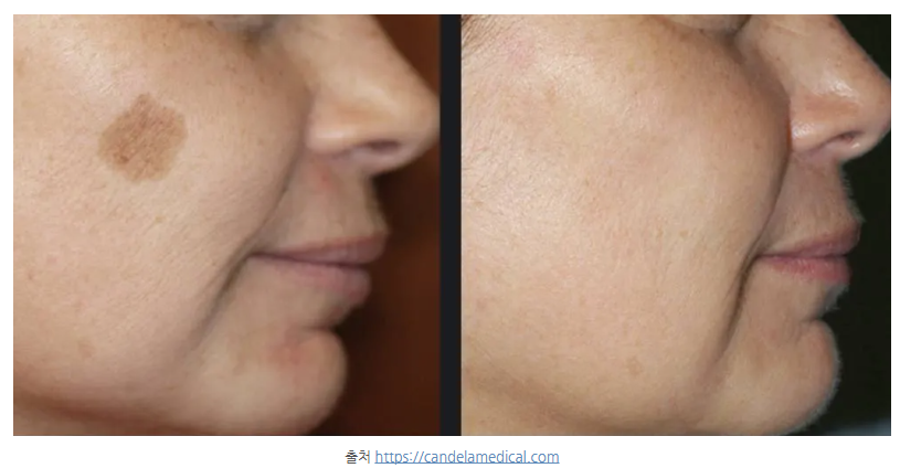 스크린샷 2025-06-07 111033.png