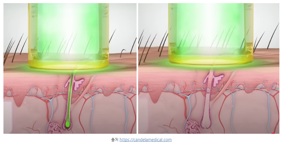 스크린샷 2025-06-07 111003.png
