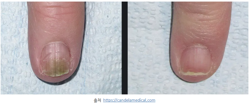 스크린샷 2025-06-07 111112.png