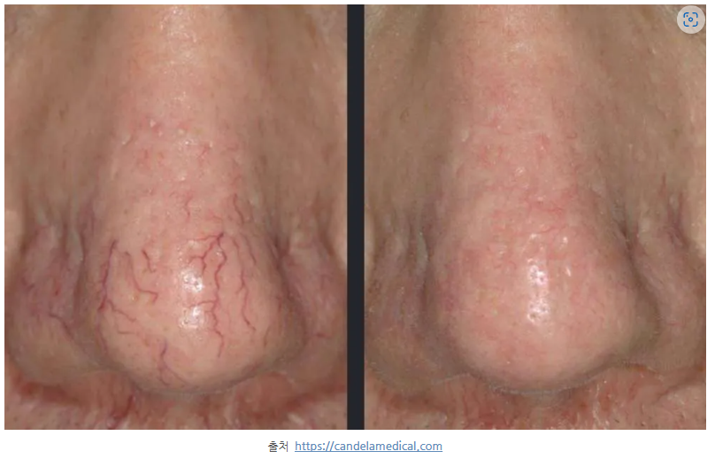 스크린샷 2025-06-07 111049.png