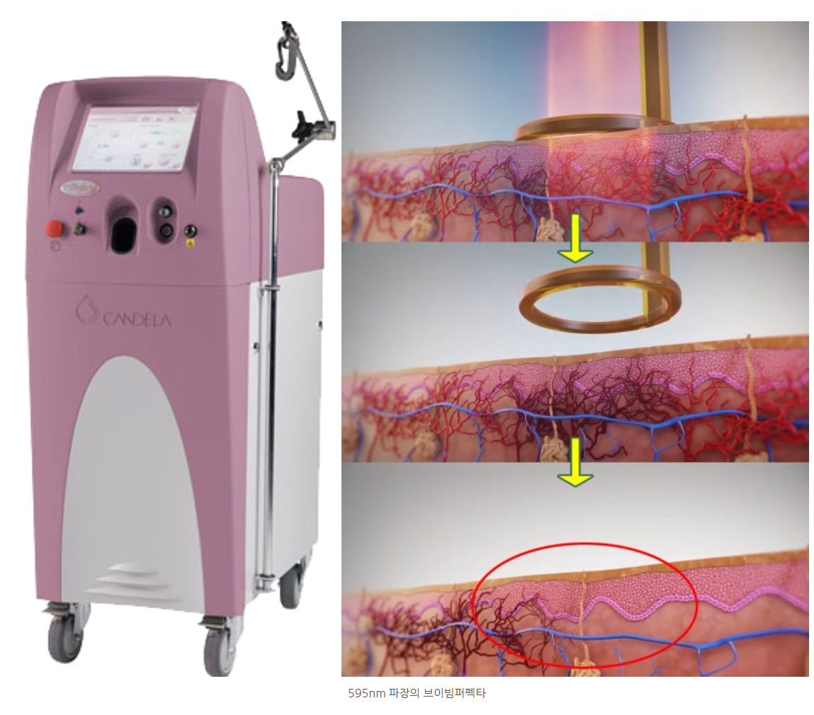 스크린샷 2025-06-07 111852.png