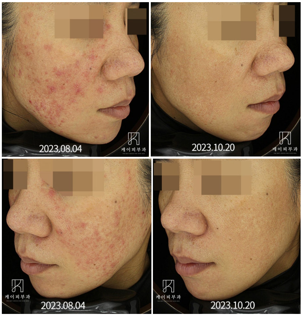 스크린샷 2025-06-07 111926.png