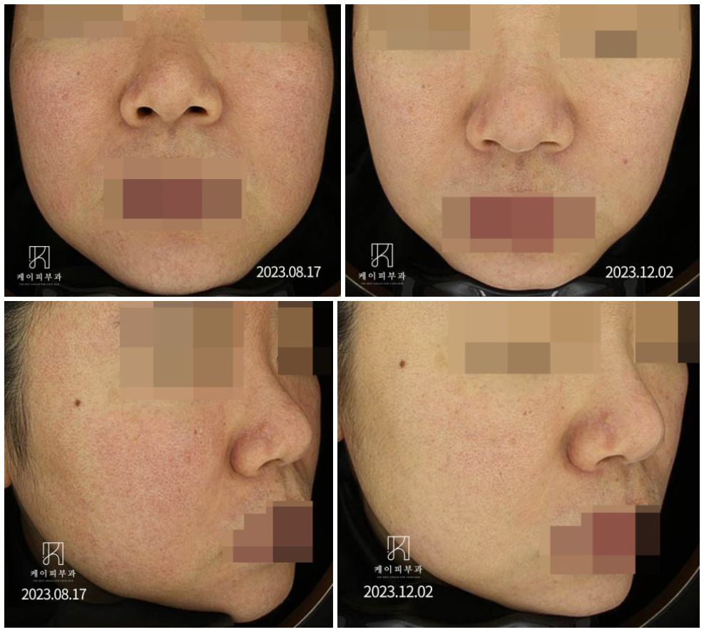 스크린샷 2025-06-07 111944.png