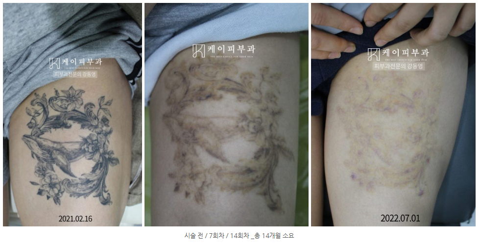 스크린샷 2025-06-07 112343.png