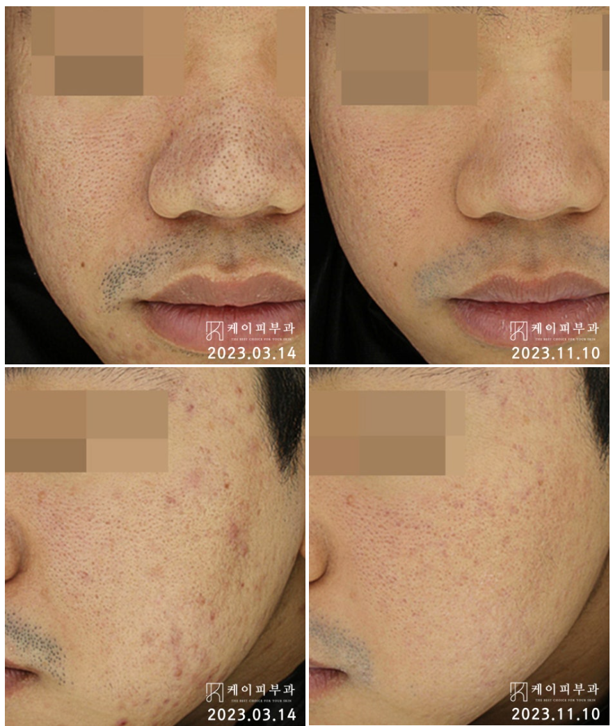 스크린샷 2025-06-07 113058.png