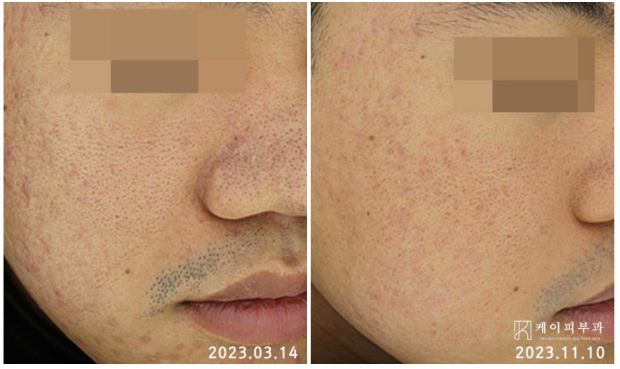 스크린샷 2025-06-07 113114.png