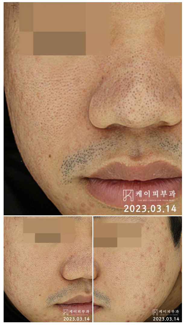 스크린샷 2025-06-07 112819.png