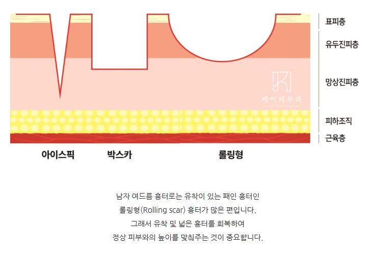 스크린샷 2025-06-07 112800.png