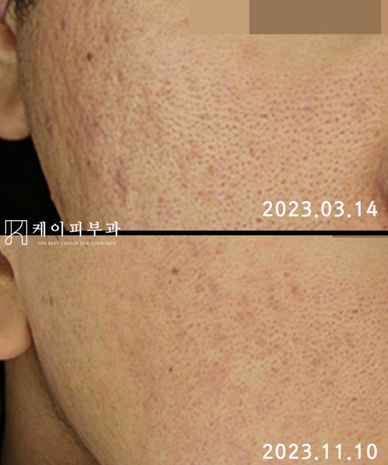 스크린샷 2025-06-07 113145.png