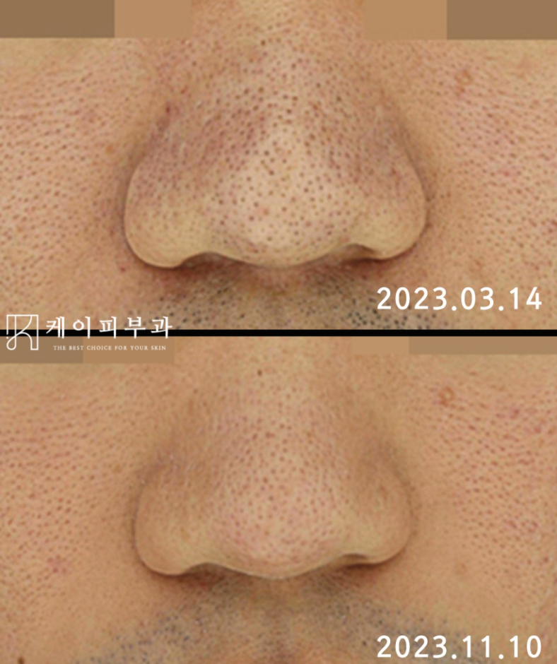 스크린샷 2025-06-07 113132.png