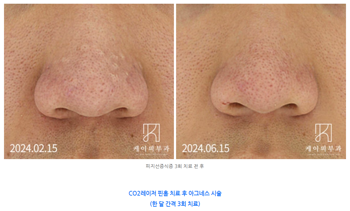 스크린샷 2025-06-07 113415.png