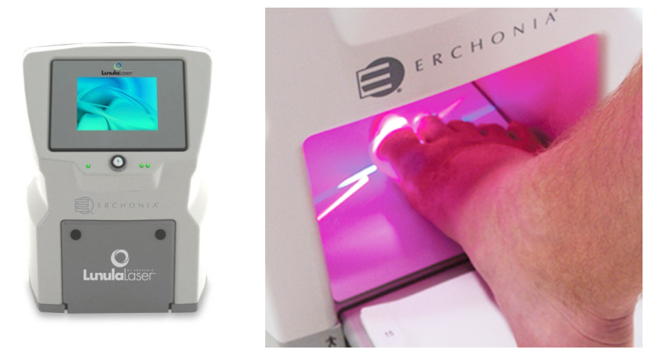 부산 노란 발톱무좀 원인 레이저치료_05.jpg