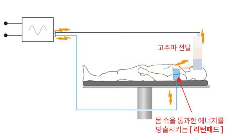 부산 고주파리프팅 VS 초음파리프팅_02.jpg