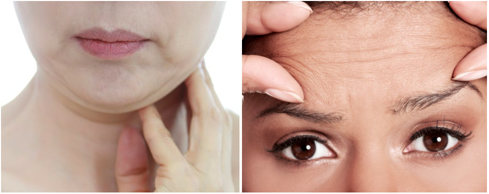 부산 고주파리프팅 VS 초음파리프팅_09.jpg