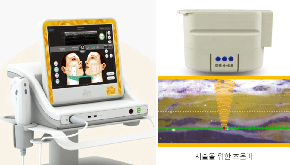 부산 고주파리프팅 VS 초음파리프팅_05.jpg