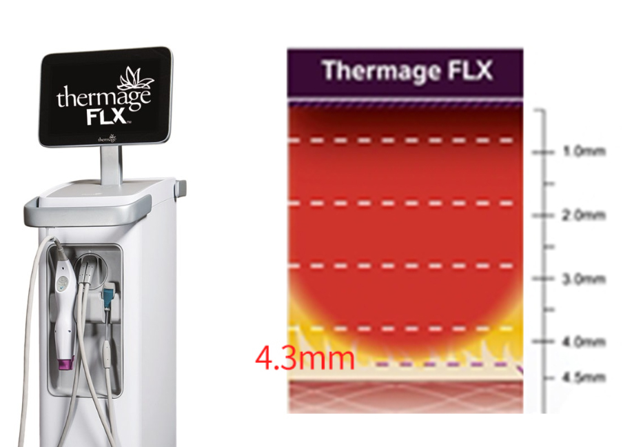 부산 고주파리프팅 VS 초음파리프팅_01.jpg