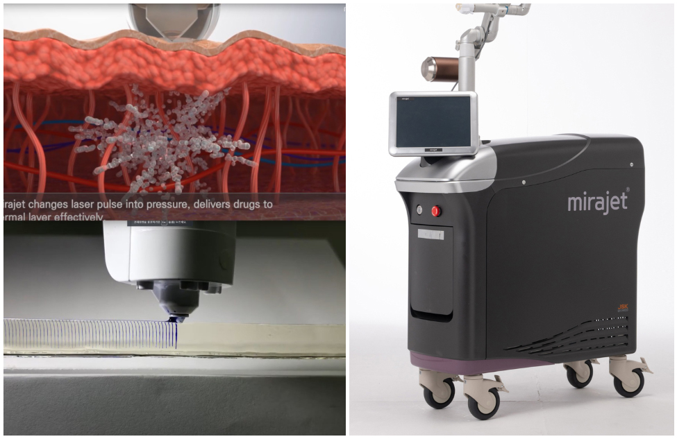 부산 여드름흉터 안면홍조 치료 후기_05.jpg