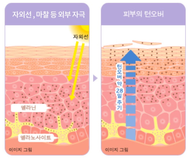 부산 레이저 부작용 치료_겨드랑이 색소침착_03.jpg
