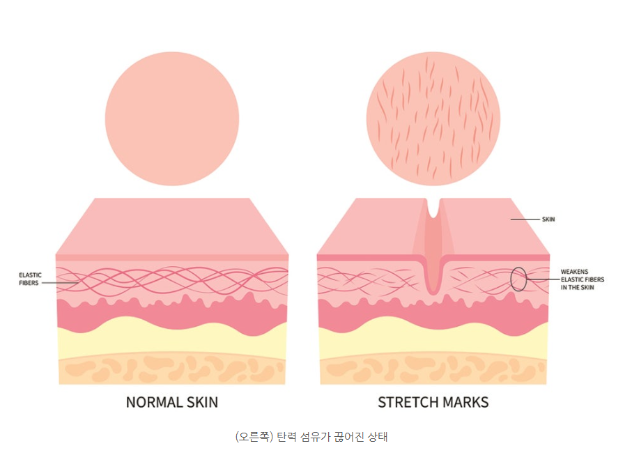 스크린샷 2025-06-14 105021.png
