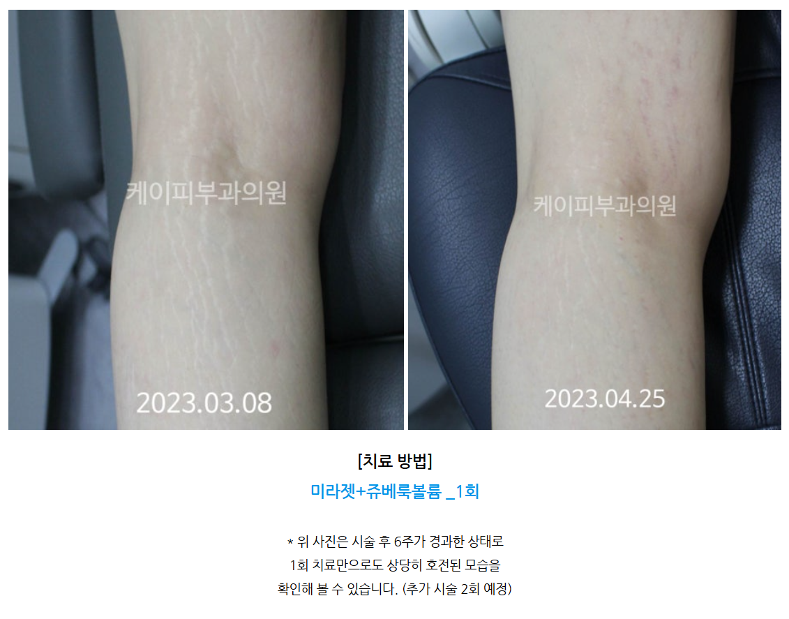 스크린샷 2025-06-14 105139.png