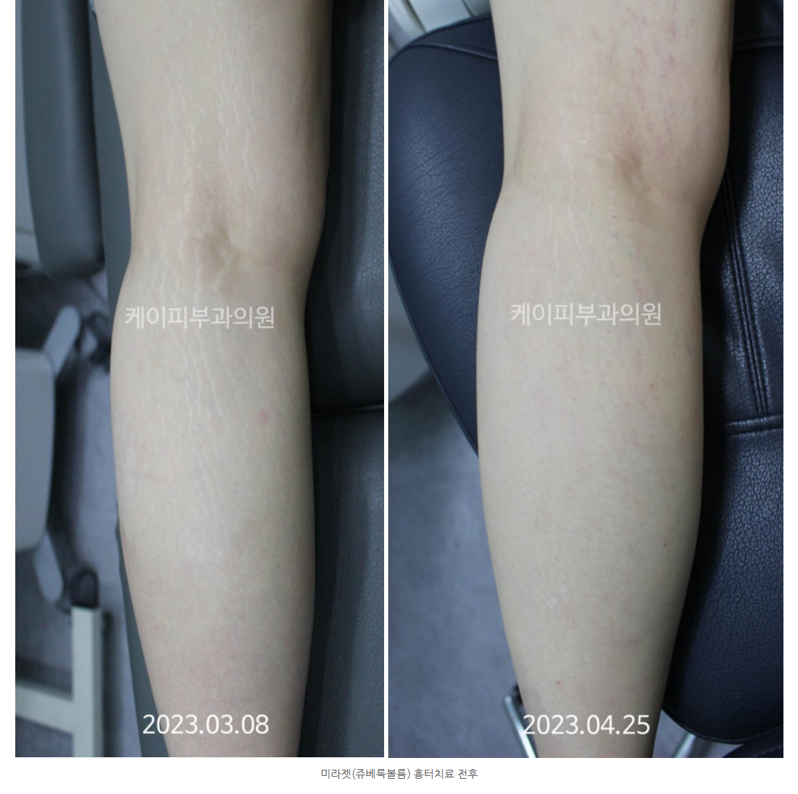 스크린샷 2025-06-14 105118.png