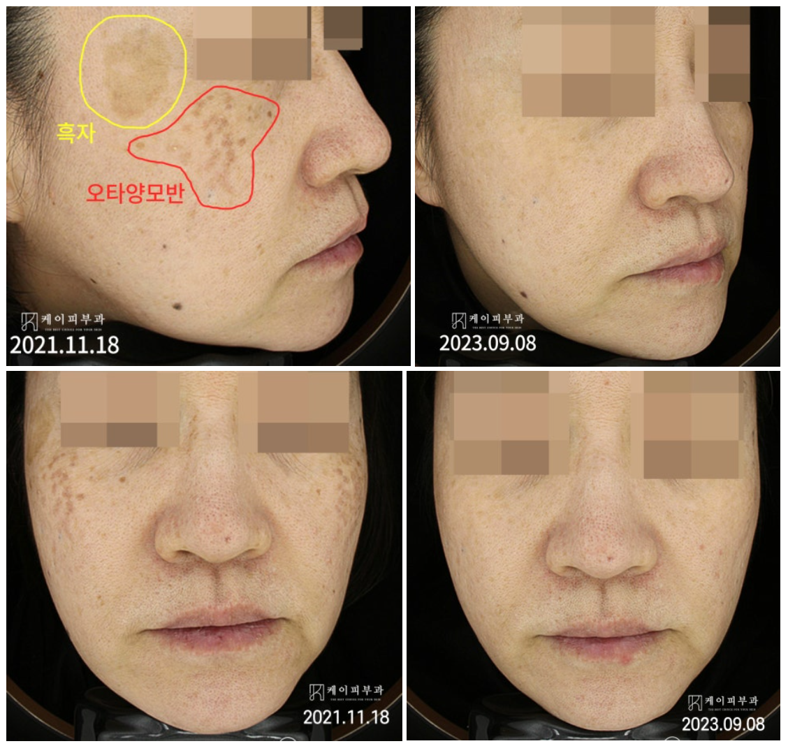 스크린샷 2025-06-14 105746.png