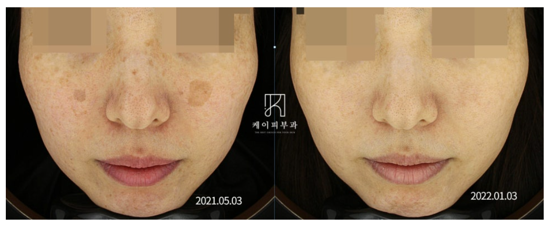 스크린샷 2025-06-14 105854.png