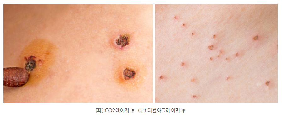 스크린샷 2025-06-14 110206.png