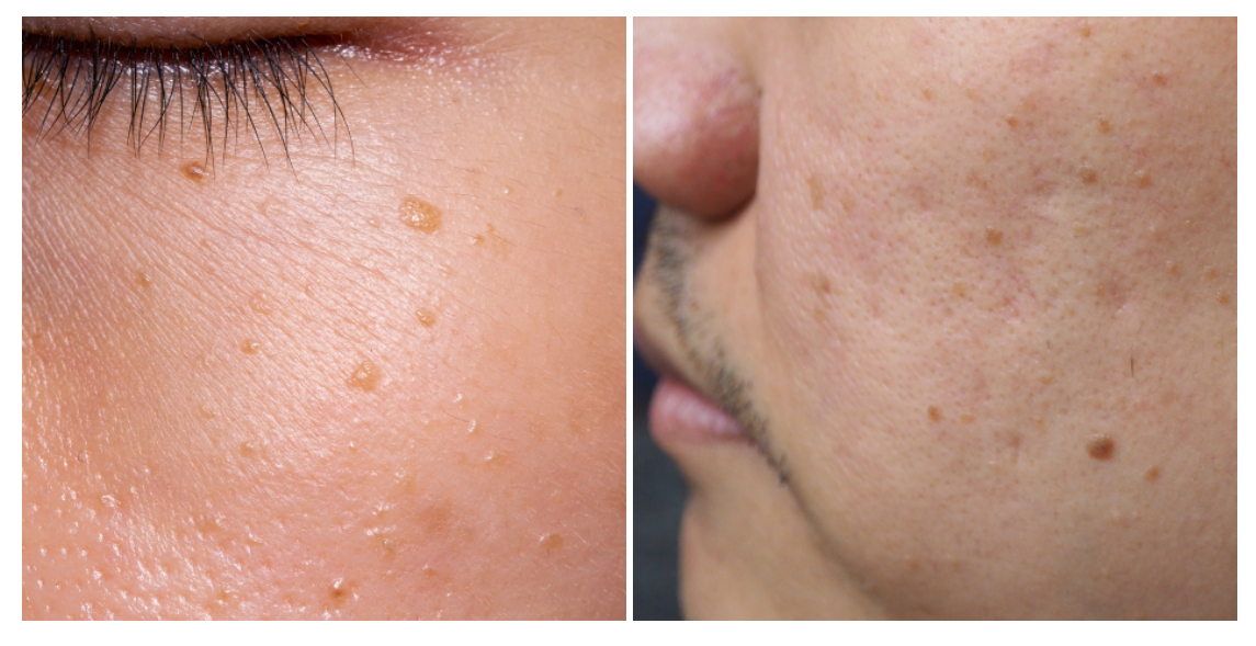 스크린샷 2025-06-14 110135.png