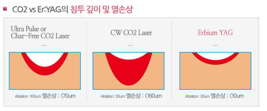 스크린샷 2025-06-14 110243.png