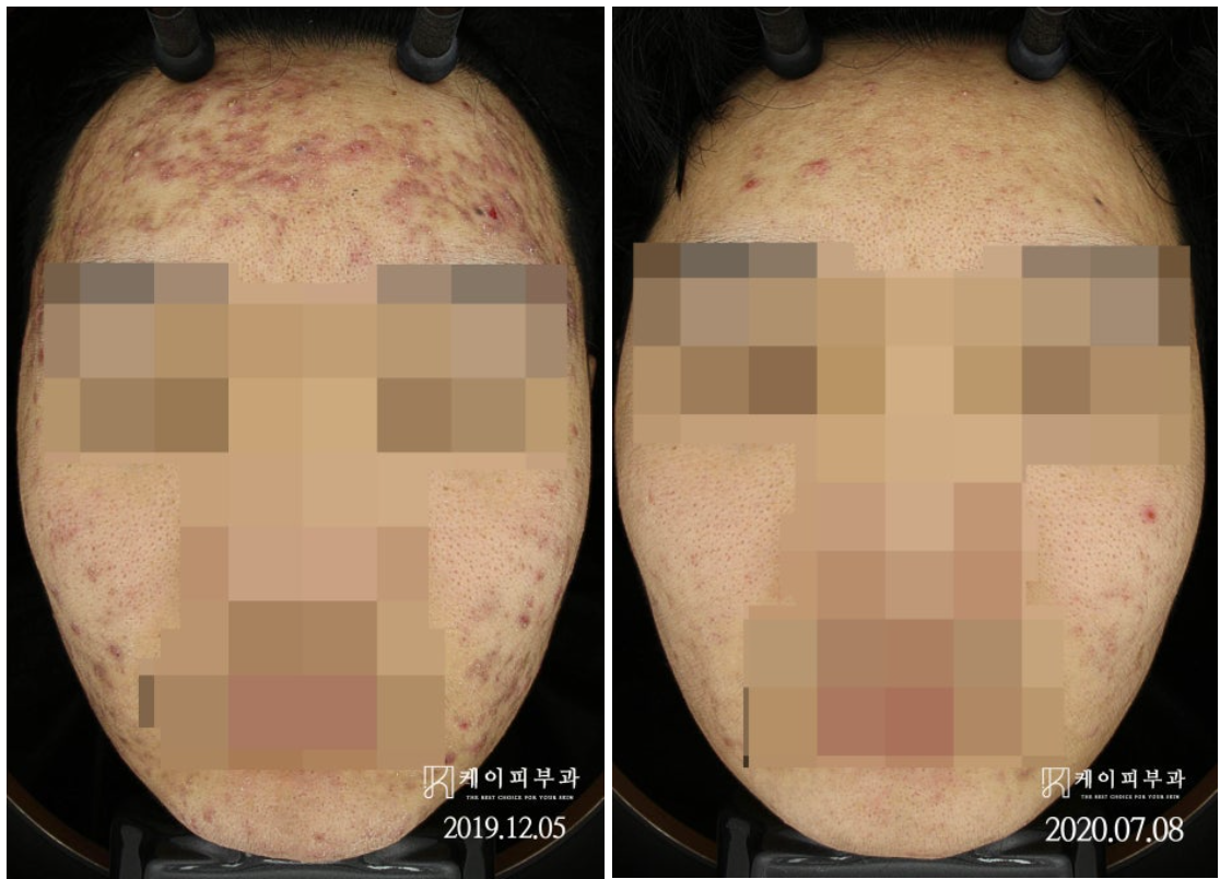 스크린샷 2025-06-14 110627.png