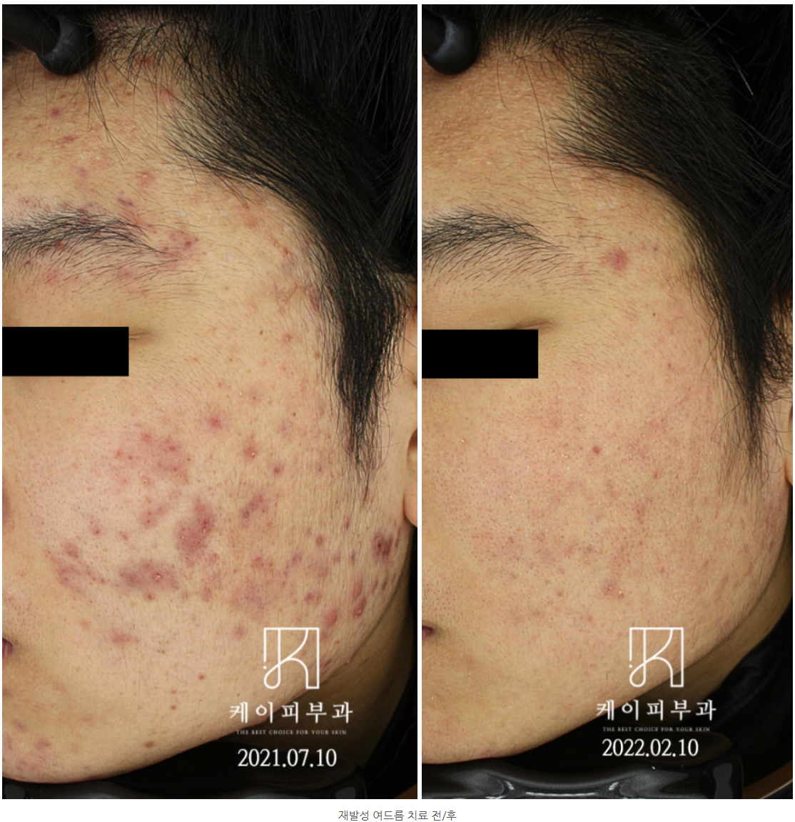 스크린샷 2025-06-14 110739.png