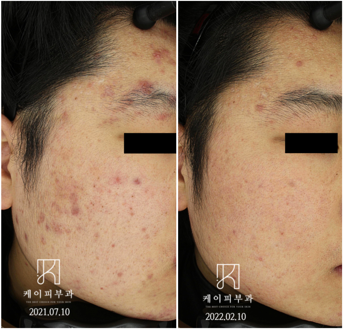 스크린샷 2025-06-14 110723.png