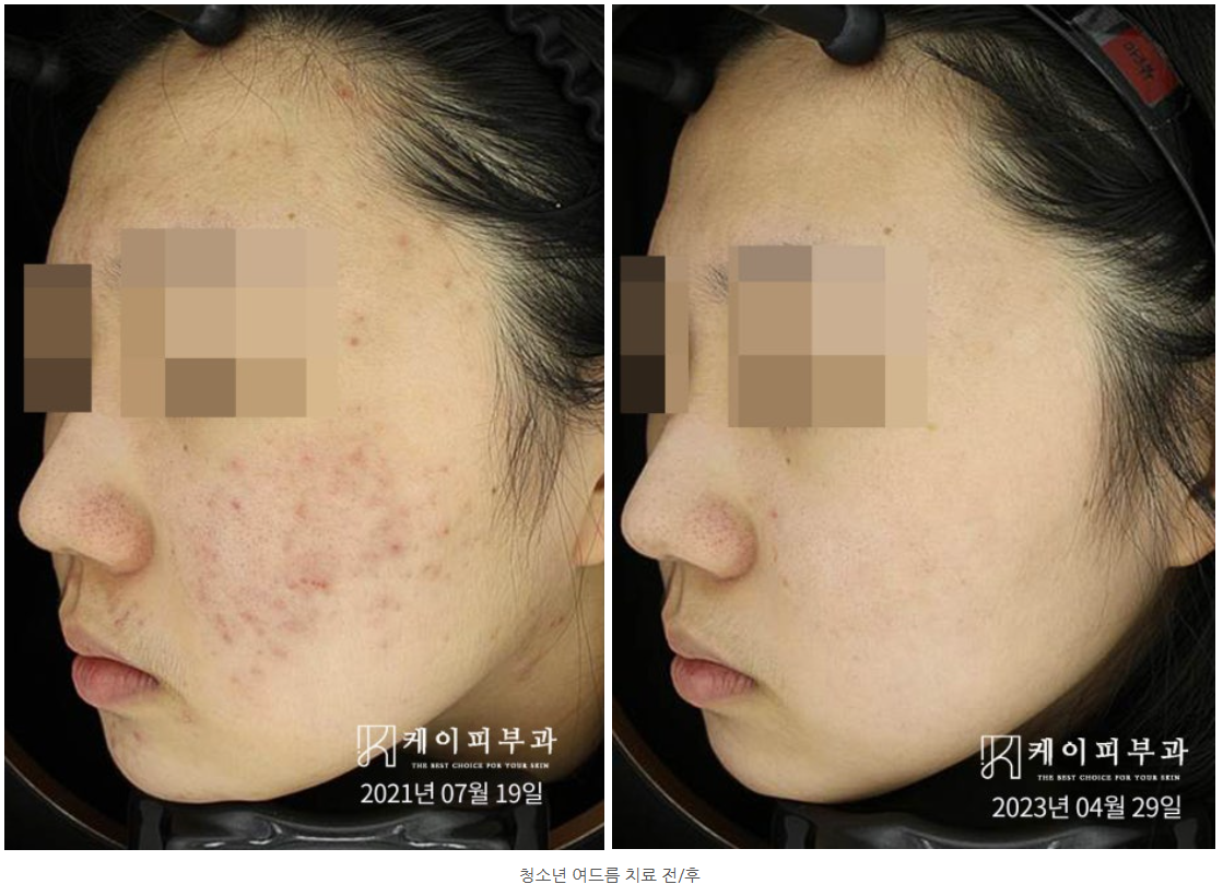 스크린샷 2025-06-14 110547.png