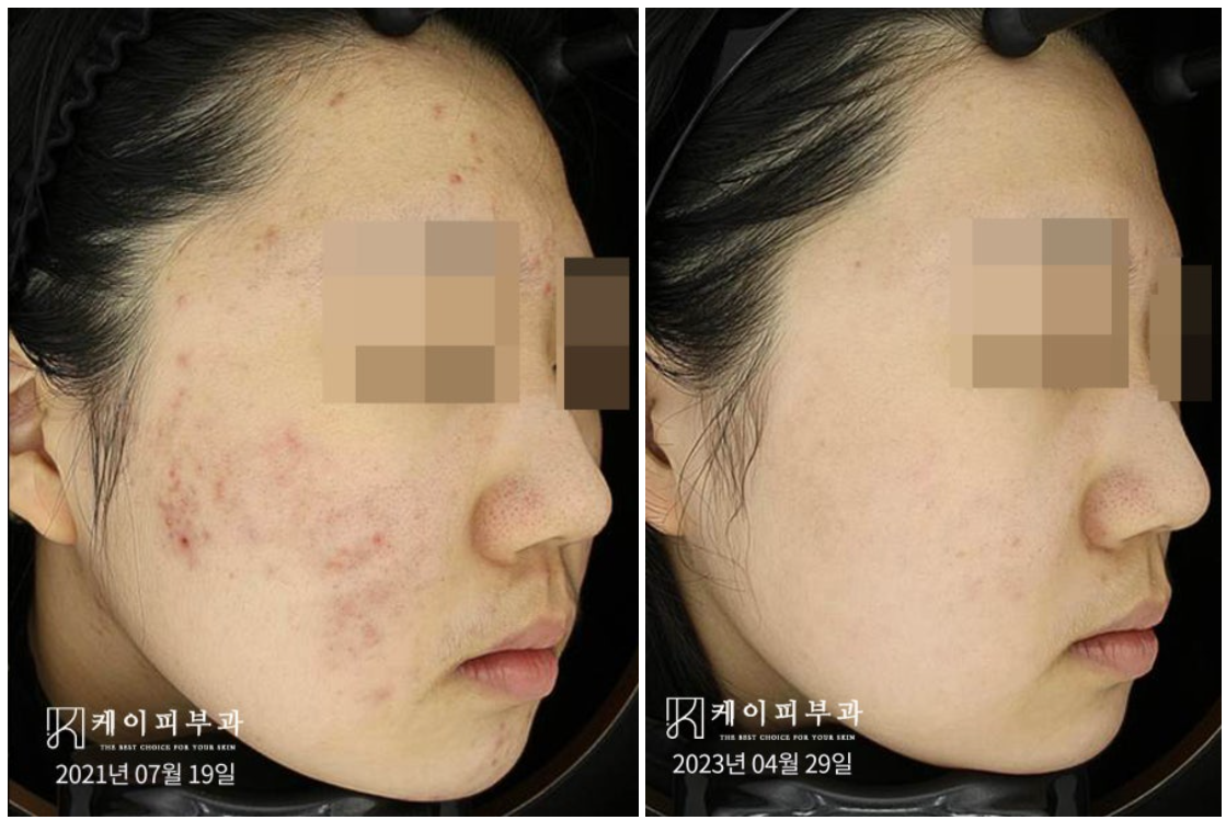 스크린샷 2025-06-14 110534.png