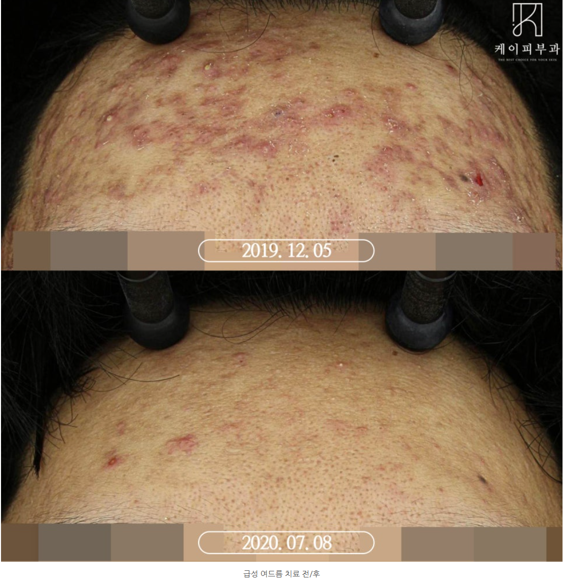 스크린샷 2025-06-14 110645.png