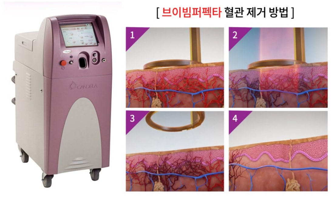 스크린샷 2025-06-14 111210.png